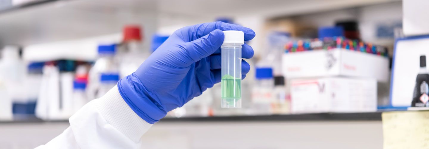 Hand holding sample tube in Professor Debbie Baines lab, Infection and Immunity Research Institute