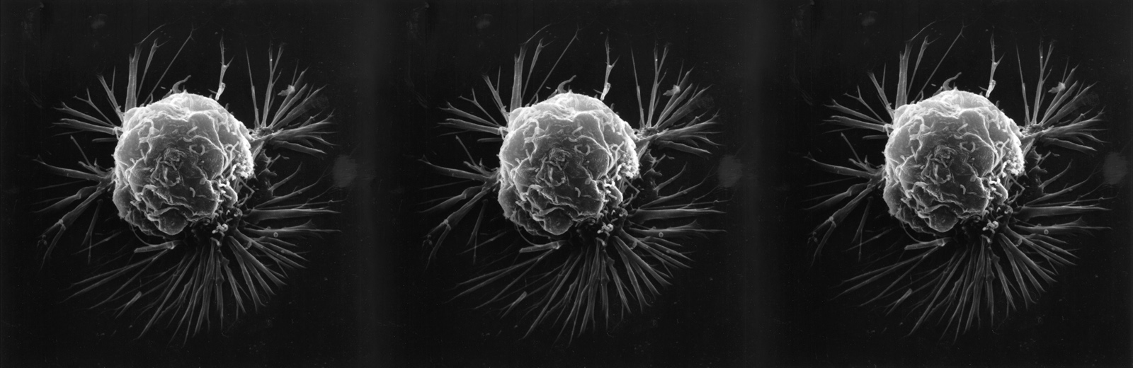 Three images of cancer cells
