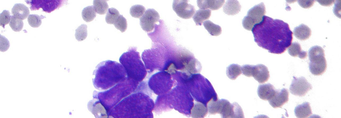 Lung cancer image banner
