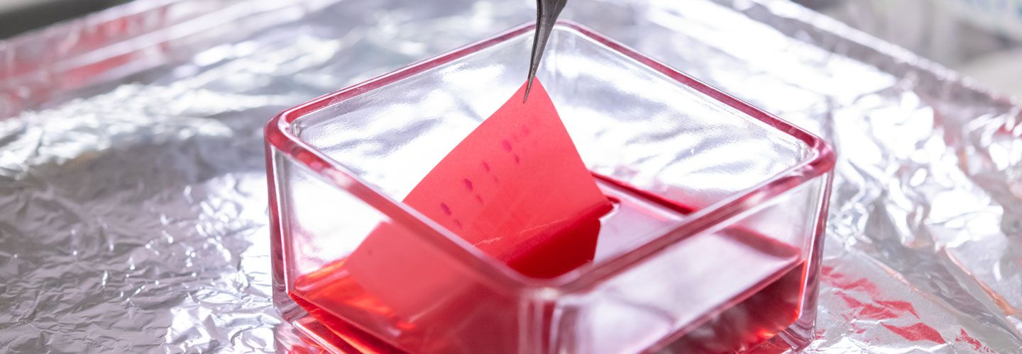 Hand holding tweezers in Professor Debbie Baines lab, Infection and Immunity Research Institute