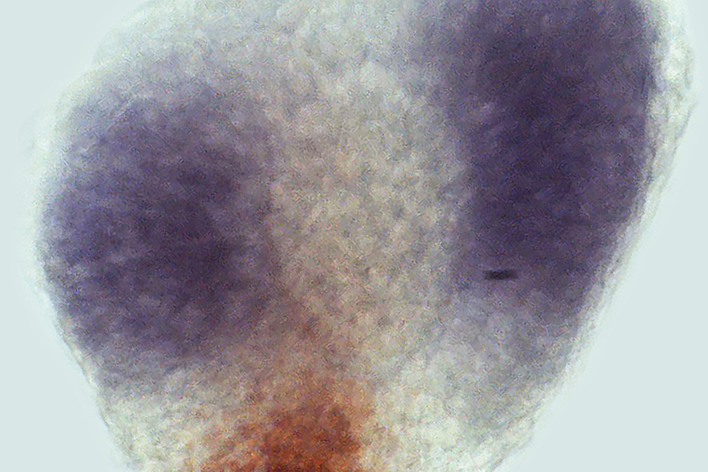 Double chromatic in situ hybridisation of a 24 hour post-fertilisation developing zebrafish eye, showing the expression of two genes: ahr1b (blue) and cyp1b1 (red)