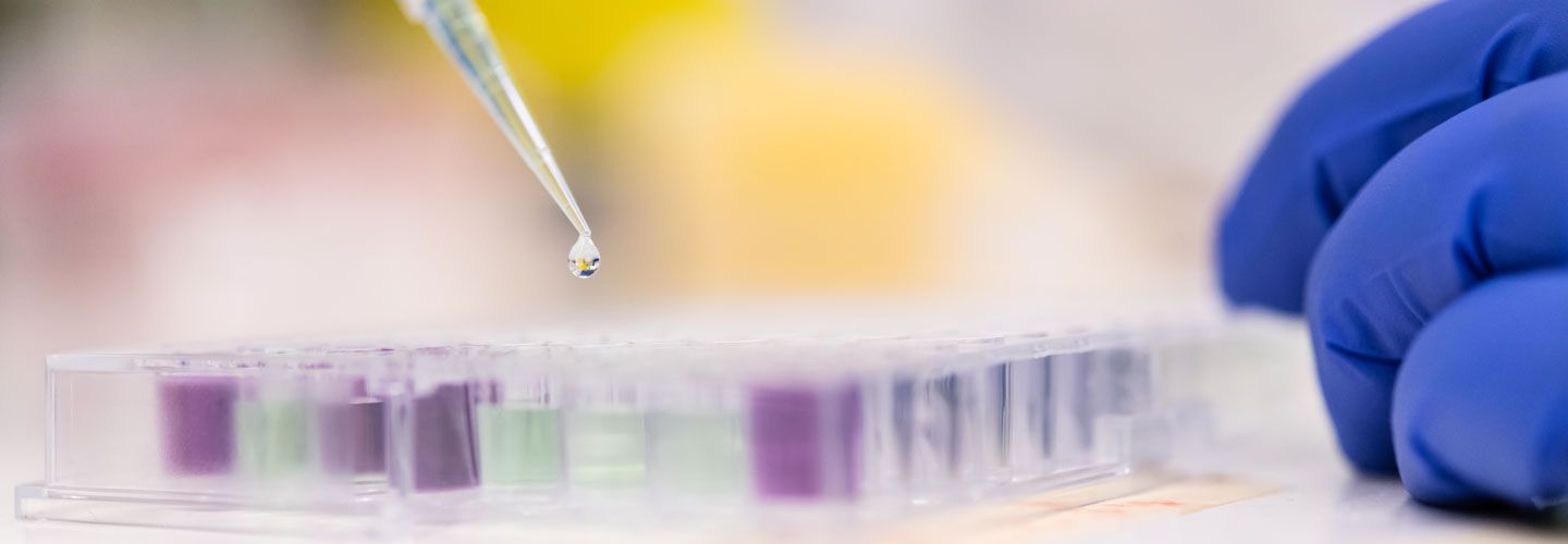 Pipetting liquid into sample wells in Professor Debbie Baines lab, Infection and Immunity Research Institute