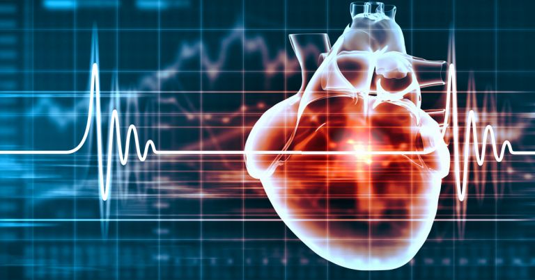 Image of a ECG