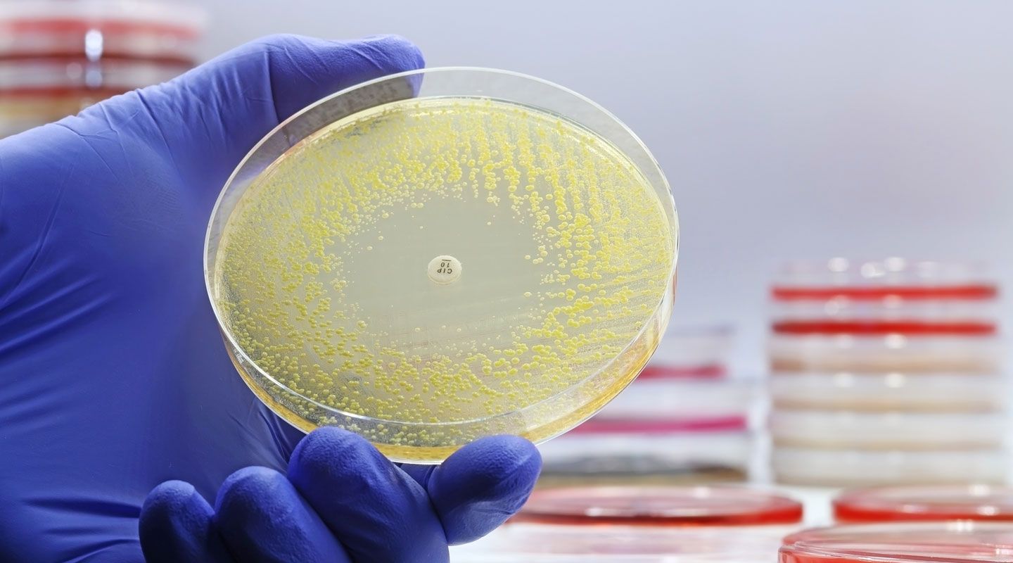 The rise of antibiotic-resistant bacterial infections. Superbugs. A microbiological culture Petri dish with bacteria where an antibiotic resistance test has been carried out