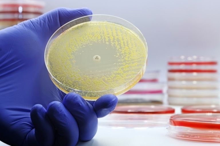 A microbiological culture Petri dish with bacteria