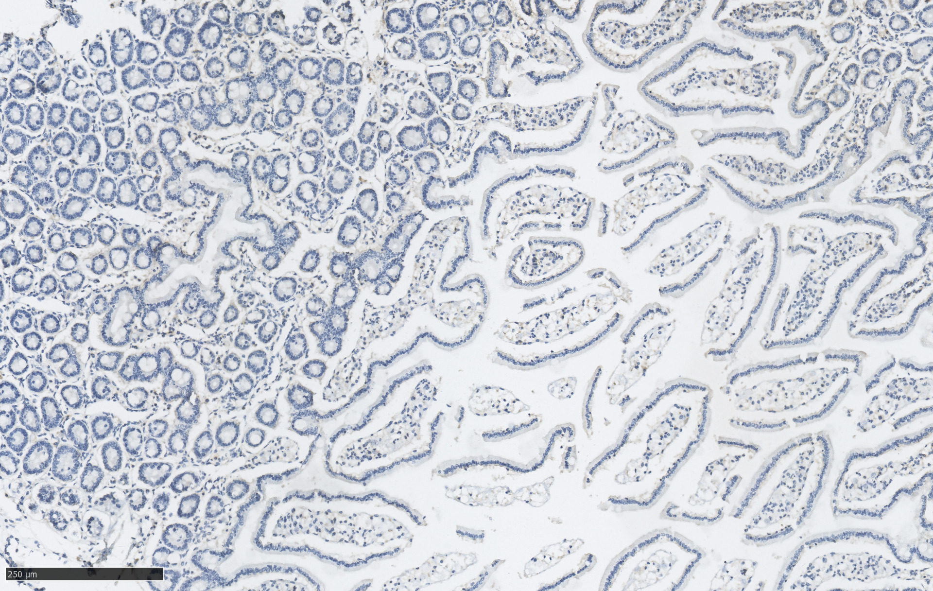 We offer customized immunohistochemistry (IHC) services designed to support the specific needs of your research.