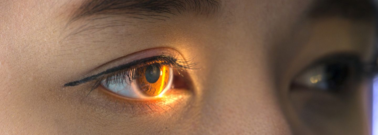 Woman having an eye test