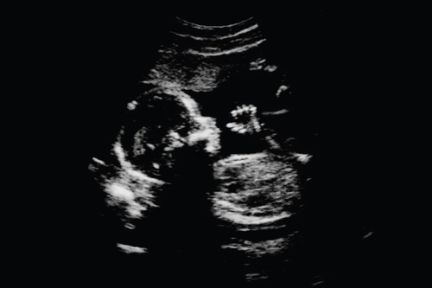 Academics help shape new national position on medicines in pregnancy