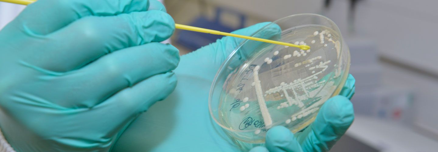 Cryptococcus sample in lab